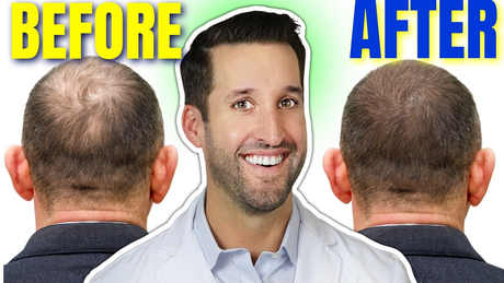 HAIR LOSS? 12 Doctor-Approved Ways to STOP Hair Loss & Regrow Hair