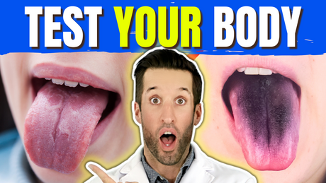 What Your Tongue Warns About Your Health