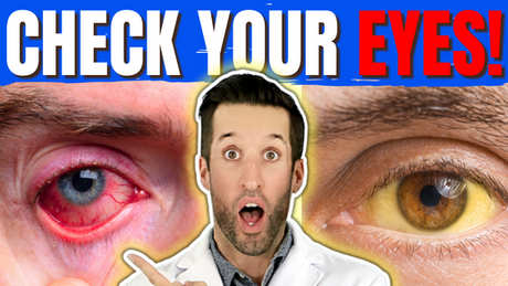 7 DANGEROUS Body Signals Your EYES Are Showing RIGHT NOW!
