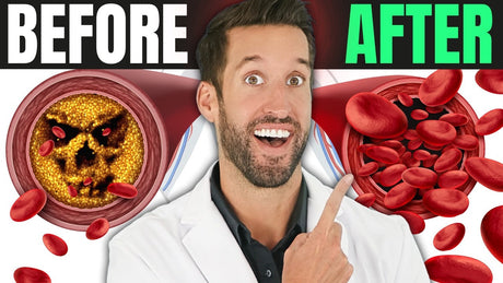 8 Easy Ways to Clean Your Arteries Naturally